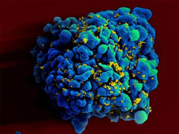 Đã tìm ra vắc xin phòng HIV?