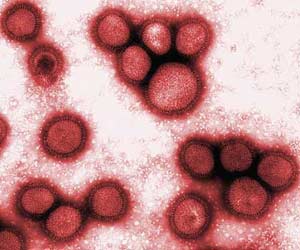 Dịch cúm & bệnh truyền nhiễm trong lịch sử con người
