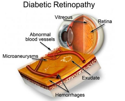 Đôi điều ít biết về cửa sổ tâm hồn