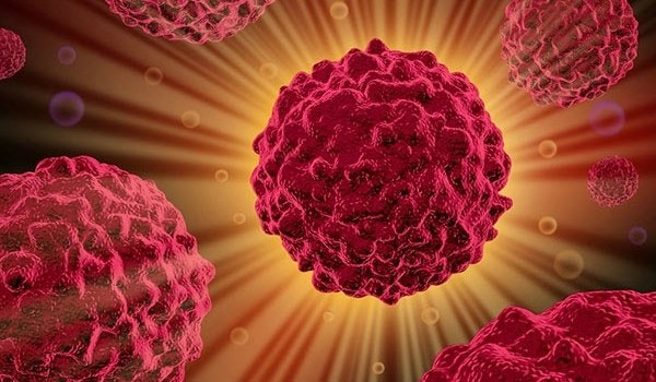 Dùng cảm biến nano chẩn đoán sớm ung thư