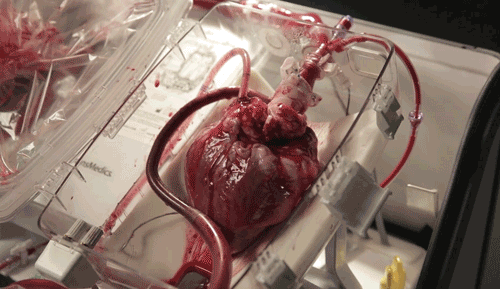 Kinh ngạc khi xem tim người vẫn đập ngoài cơ thể khi chờ cấy ghép
