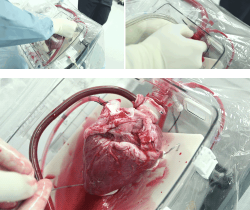 Kinh ngạc khi xem tim người vẫn đập ngoài cơ thể khi chờ cấy ghép