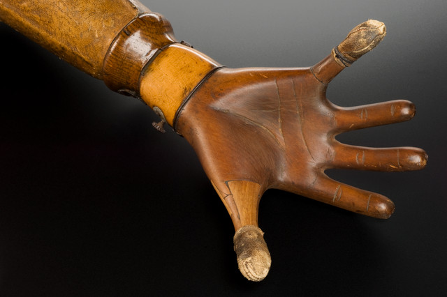 Lịch sử chế tạo chân tay giả trên thế giới
