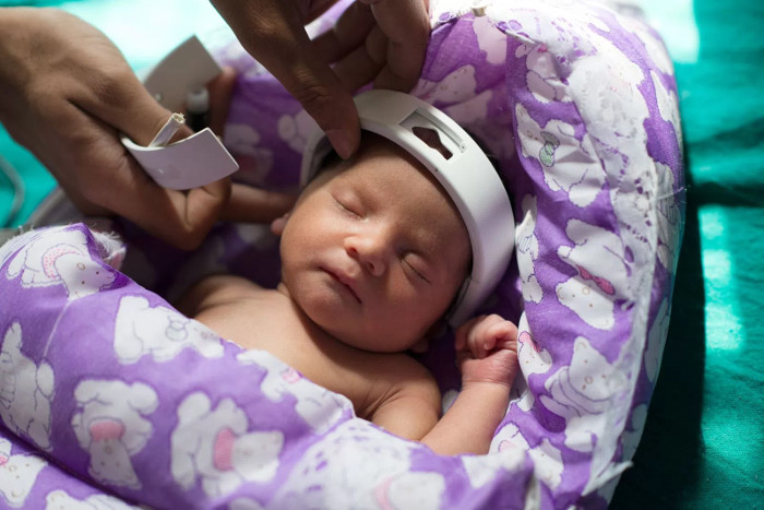 Mexico sáng chế thiết bị chẩn đoán nhanh bệnh điếc ở trẻ sơ sinh