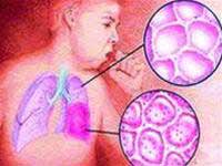 Mùa đông và bệnh viêm phế quản - phổi ở trẻ em