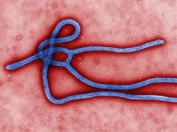 Nga cảnh báo nguy cơ Ebola thành vũ khí sinh học