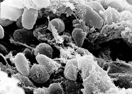 Nhà nghiên cứu dịch hạch chết vì dịch hạch