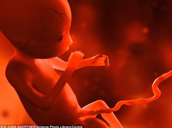 Phát hiện bào thai trong bụng bé trai 4 tuổi