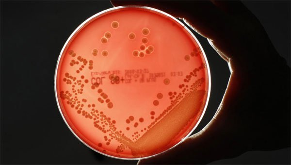 Phát hiện điểm yếu của “siêu vi khuẩn” kháng thuốc