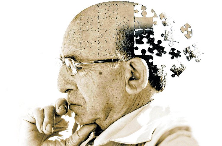 Phát hiện thuốc chống viêm có thể trị bệnh Alzheimer