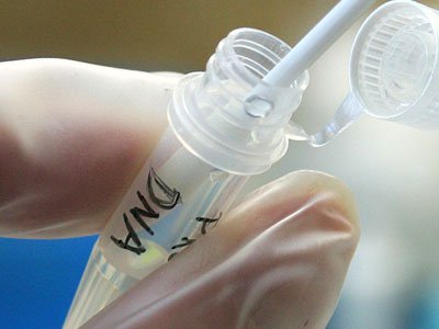 Phát hiện ưu thế của xét nghiệm ADN từ nước bọt