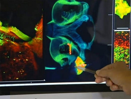 Phát triển công nghệ chụp não cho bệnh nhân cấy ghép ốc tai