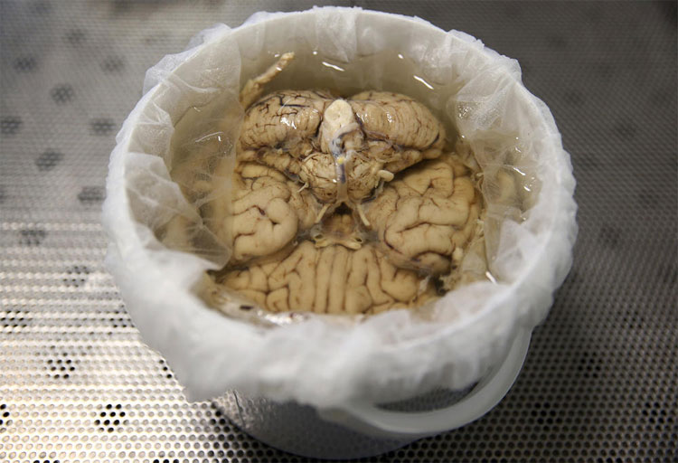 Quy trình biến não người thành bất tử ở Mỹ