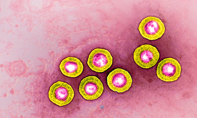 Sắp có vắc xin ngừa virus herpes gây bệnh tình dục