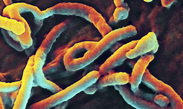 Senegal xác nhận trường hợp đầu tiên nhiễm Ebola là du học sinh