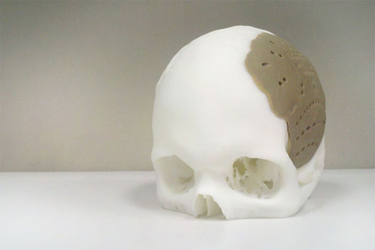 Tái tạo các bộ phận trên cơ thể bằng công nghệ in 3D