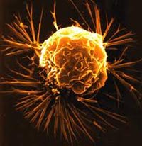 Tế bào phát sinh vụ nổ lớn gây ung thư bất ngờ