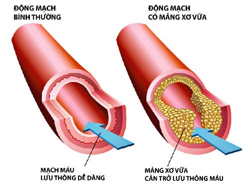 Thần dược giúp bạn giảm mỡ máu