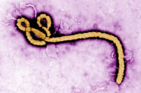 Thế giới bất lực trước dịch Ebola vì... sex