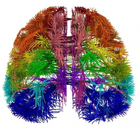 Vẽ sơ đồ não bộ theo phong cách bảy sắc cầu vồng