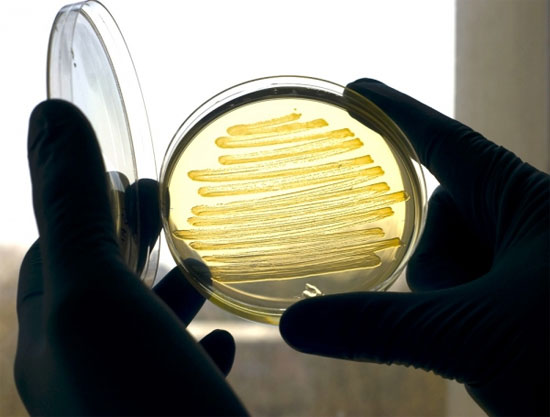 Vi khuẩn E.coli có thể sản xuất diezel