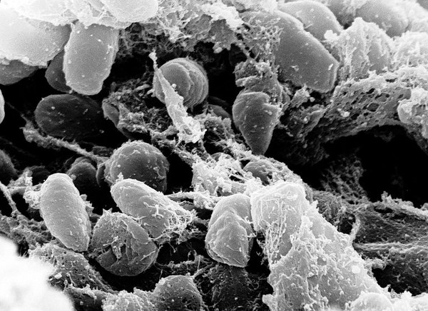 Vi khuẩn tưởng chừng vô hại này đã giết hại 1/3 dân số thế giới ngày trước