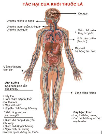 Việt Nam có tỷ lệ hút thuốc lá cao nhất thế giới