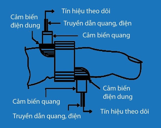 Việt Nam sắp có máy đo tiểu đường không cần chích máu?