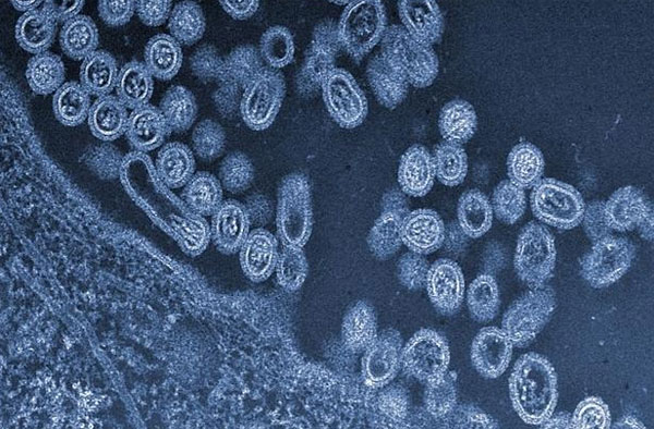 Virus cúm H7N9 đang nguy hiểm hơn