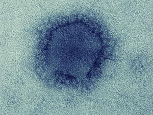 Virus gây bệnh MERS từng lây từ động vật sang người