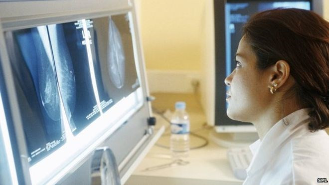 X-quang can thiệp, một bước ngoặt trong điều trị ung thư