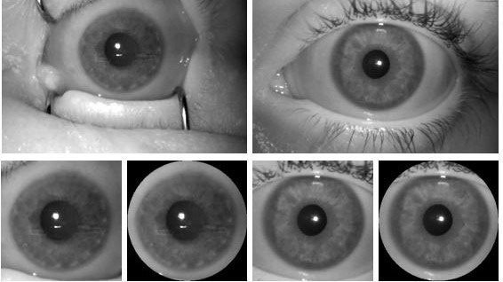 Công nghệ quét mống mắt có thể phân biệt được mắt người sống và người chết
