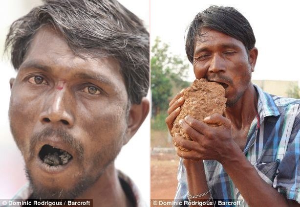 Hãi hùng dị nhân ăn 3kg bùn đất mỗi ngày, nhai gạch như bim bim