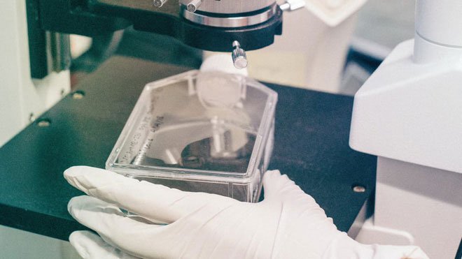 Kỹ thuật chỉnh sửa gene CRISPR sẽ khiến tế bào ung thư không còn bất tử