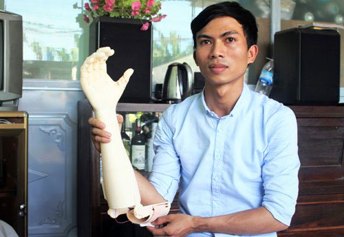 Nam sinh chế tạo bàn tay robot giá rẻ cho người khuyết tật