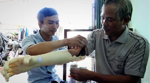 Nam sinh chế tạo bàn tay robot giá rẻ cho người khuyết tật