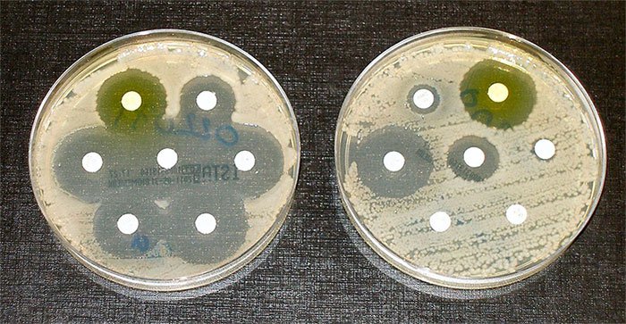 Vi khuẩn kháng thuốc có thể lan tỏa theo đường không khí, và đây là tin không tốt chút nào