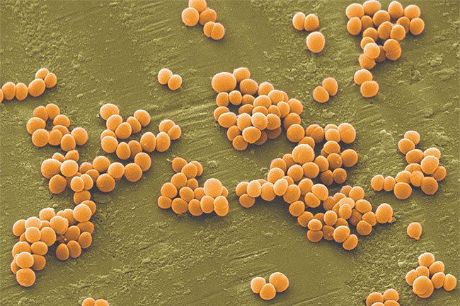 Vi khuẩn tụ cầu vàng xâm nhập qua thực phẩm nguy hiểm thế nào?