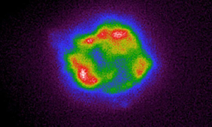 Ảnh chụp tia X đầu tiên về tàn dư siêu tân tinh