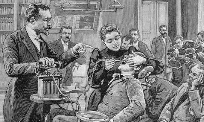 Bệnh dịch răng nổ kỳ lạ vào thế kỷ 19