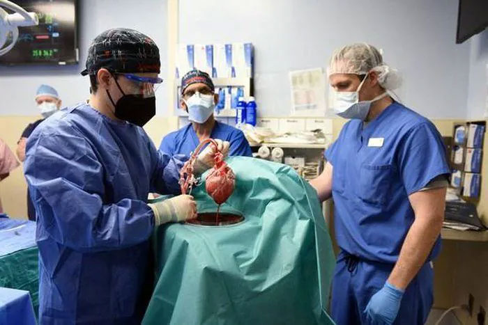 Bệnh nhân nhận tim lợn cấy ghép đầu tiên trên thế giới đã tử vong