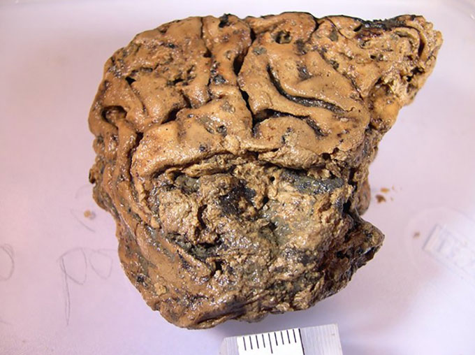 Bí ẩn não người cổ đại tồn tại nguyên vẹn trong 2.600 năm không phân huỷ
