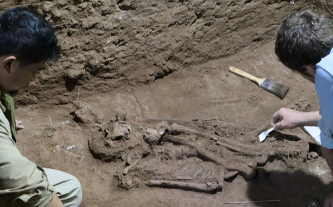Bộ hài cốt làm đảo lộn lịch sử ở Indonesia: Ca phẫu thuật sốc 31.000 năm trước