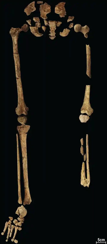 Bộ hài cốt làm đảo lộn lịch sử ở Indonesia: Ca phẫu thuật sốc 31.000 năm trước