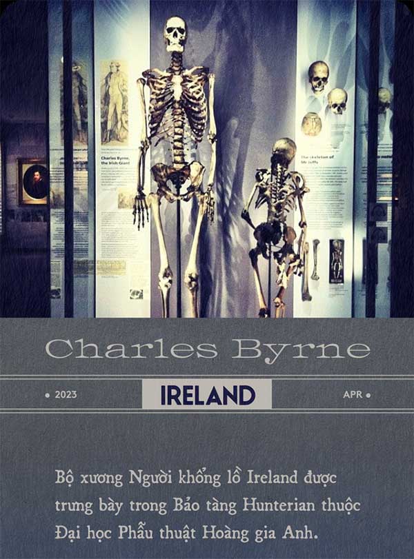 Bộ xương Người khổng lồ Ireland: Tấn bi kịch gây tranh cãi nhất lịch sử Anh Quốc