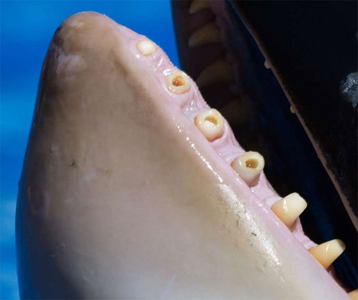 Cá voi sát thủ có thể tử vong vì... đau răng