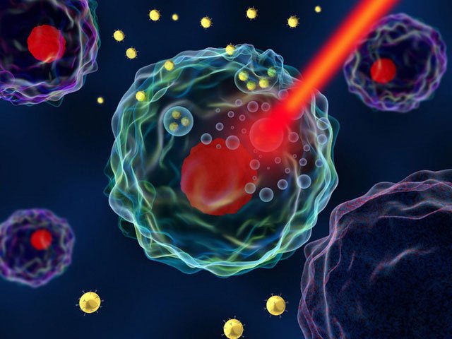 Các nhà khoa học teleport nano vàng vào tế bào ung thư và tiêu diệt chúng từ bên trong