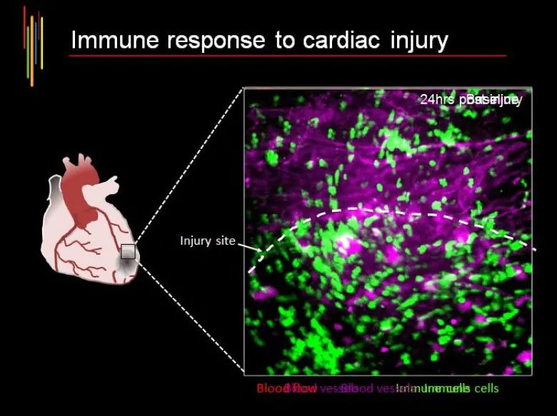 Các nhà khoa học tìm thấy một loại tế bào hoàn toàn mới, giúp chữa lành tổn thương trong trái tim