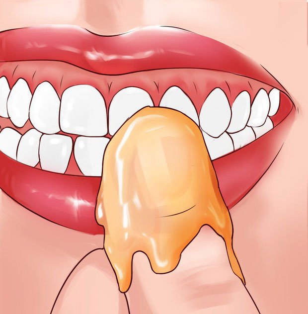 Cách khắc phục tình trạng chảy máu nướu răng