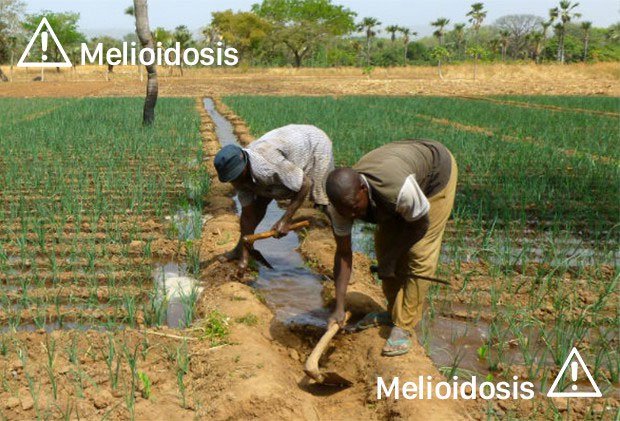 Căn bệnh giết người bị lãng quên: Đôi chân đất của người nông dân và siêu vi khuẩn dưới bùn ruộng